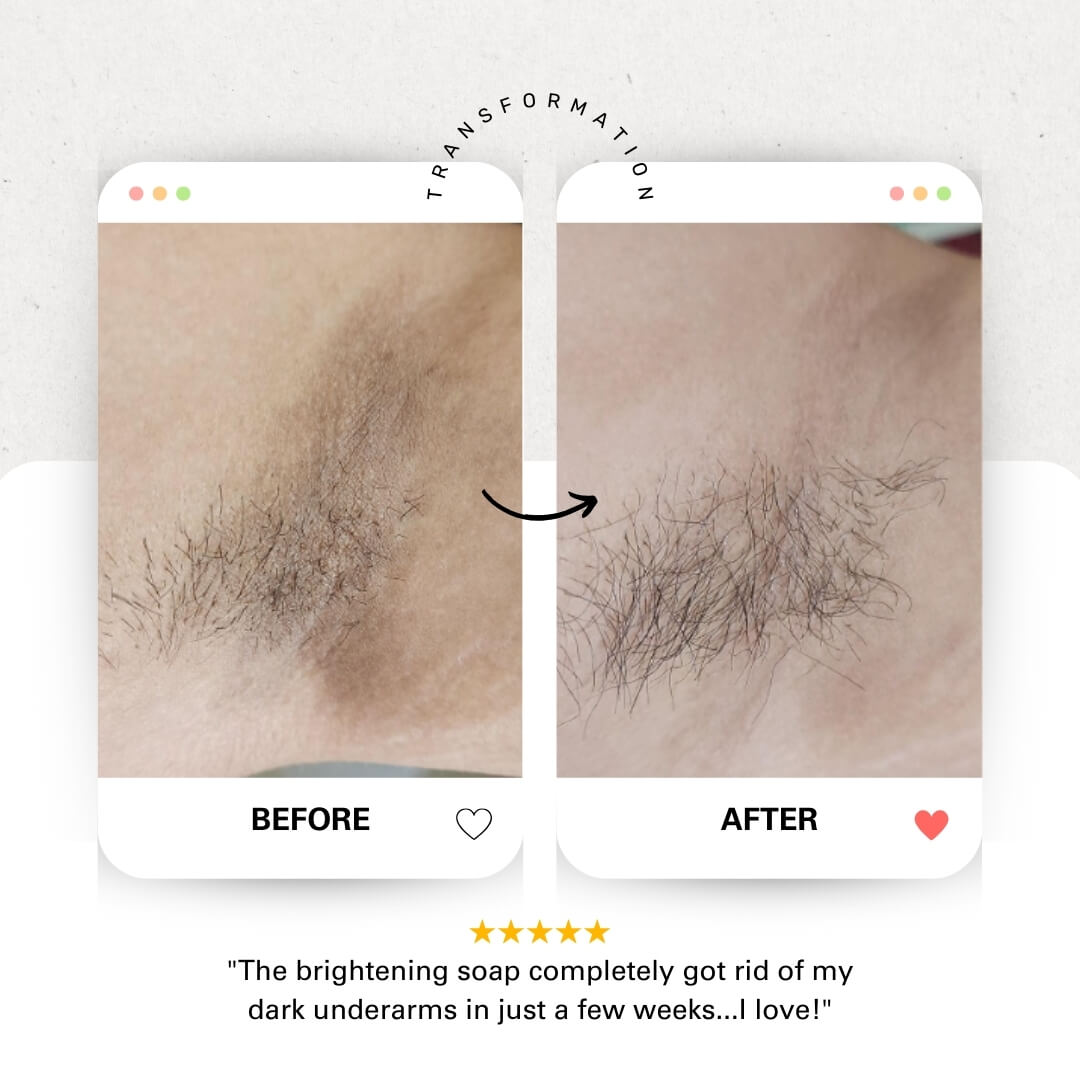 Blissal Turmeric Soap