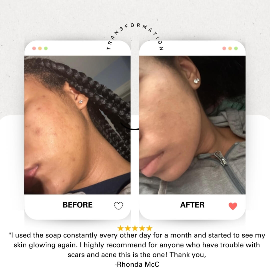 Blissal Turmeric Soap