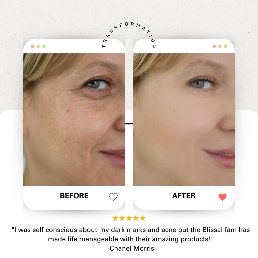 Blissal Turmeric Soap