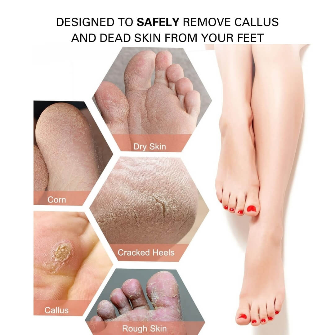 Blissal Rechargeable Foot Callus Remover